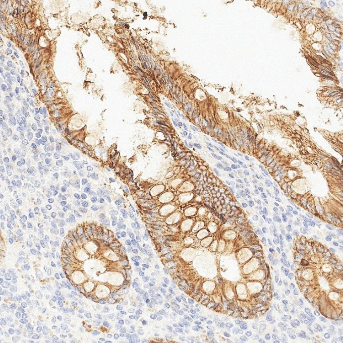 IHC staining of human appendicitis using 84073-6-RR