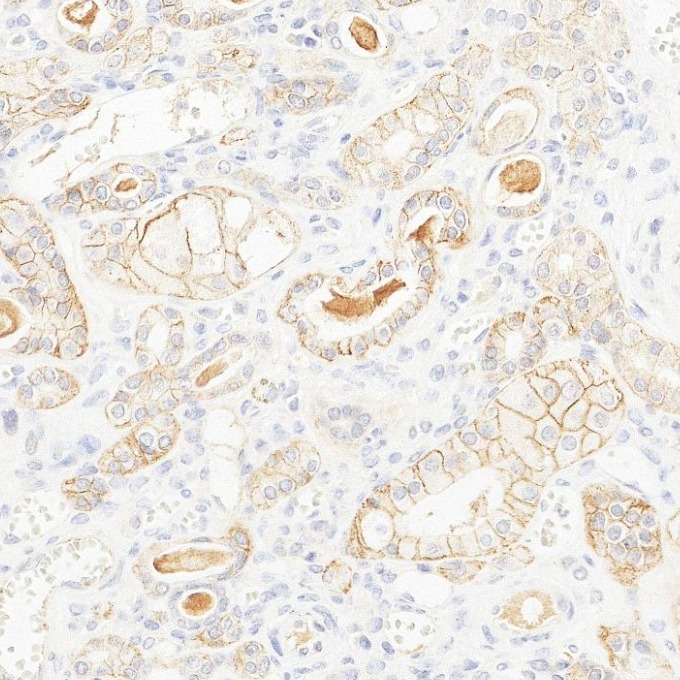 IHC staining of human kidney using 84073-6-RR