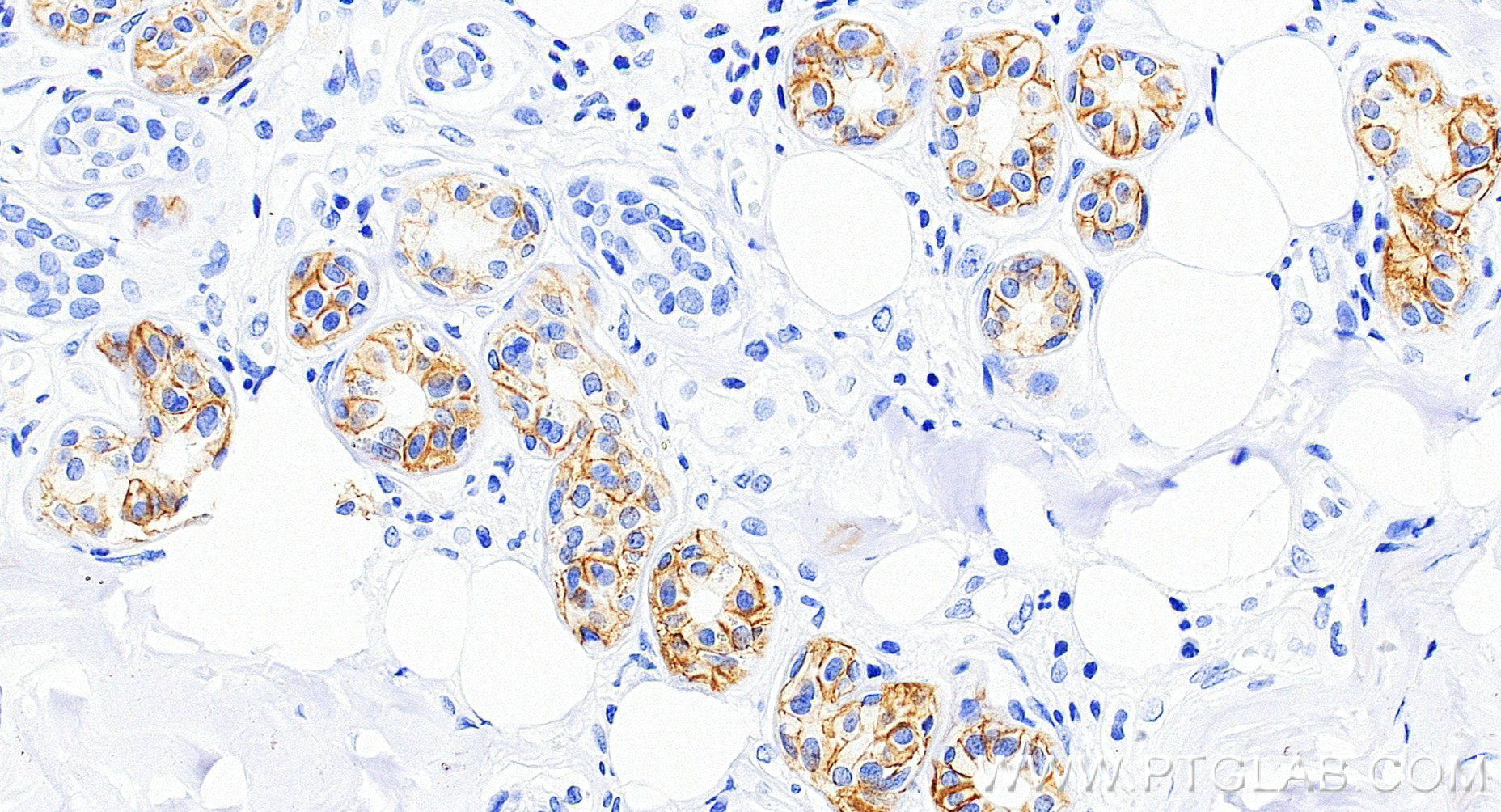 IHC staining of human skin using 84073-6-RR