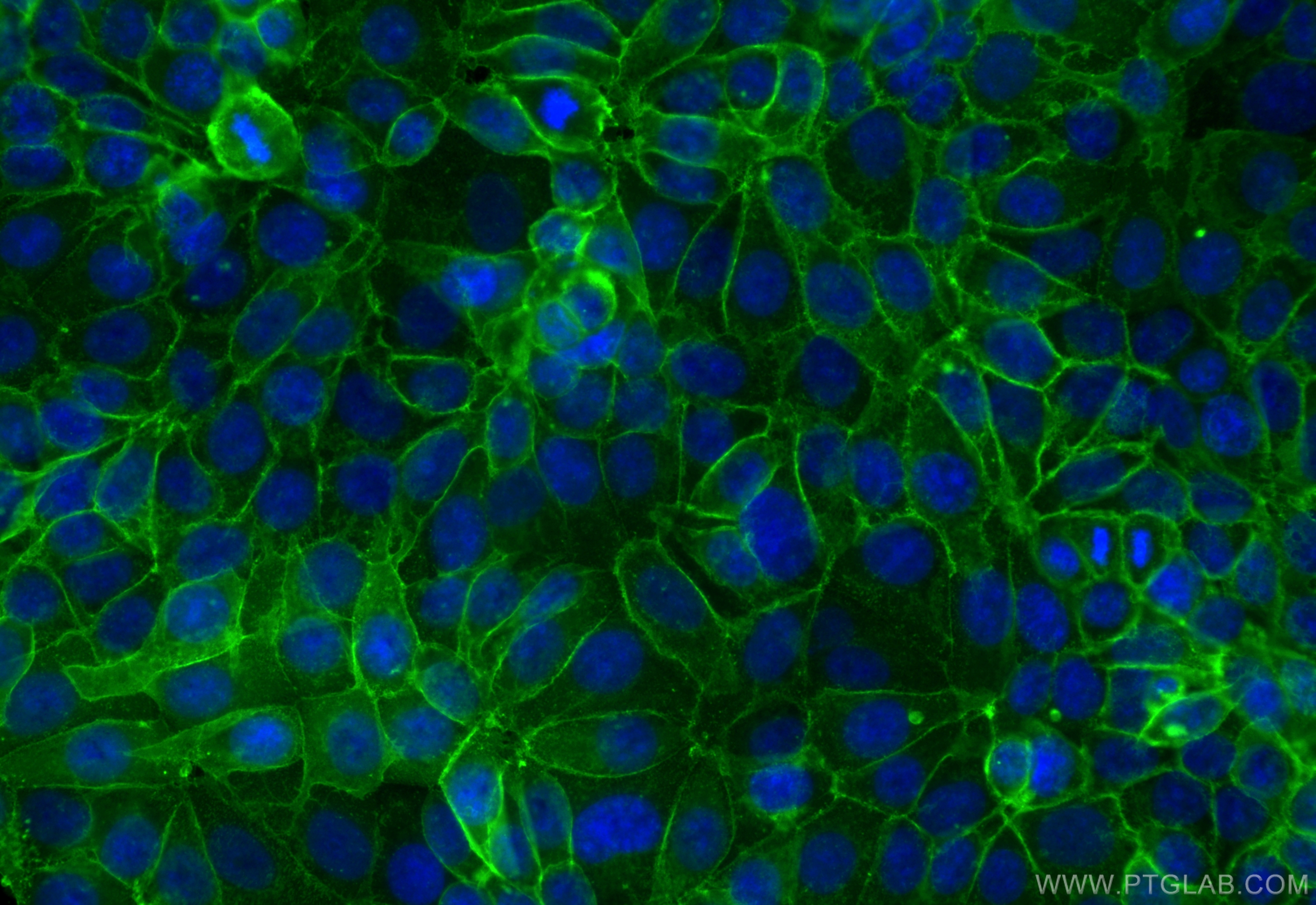 EPCAM/CD326