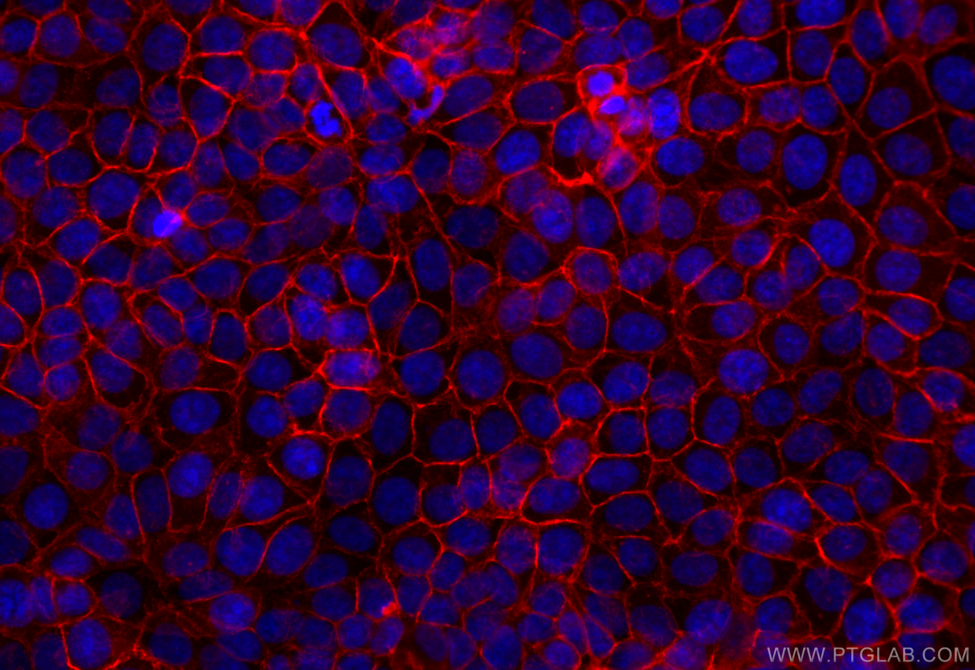 IF Staining of MCF-7 using CL594-84073-6