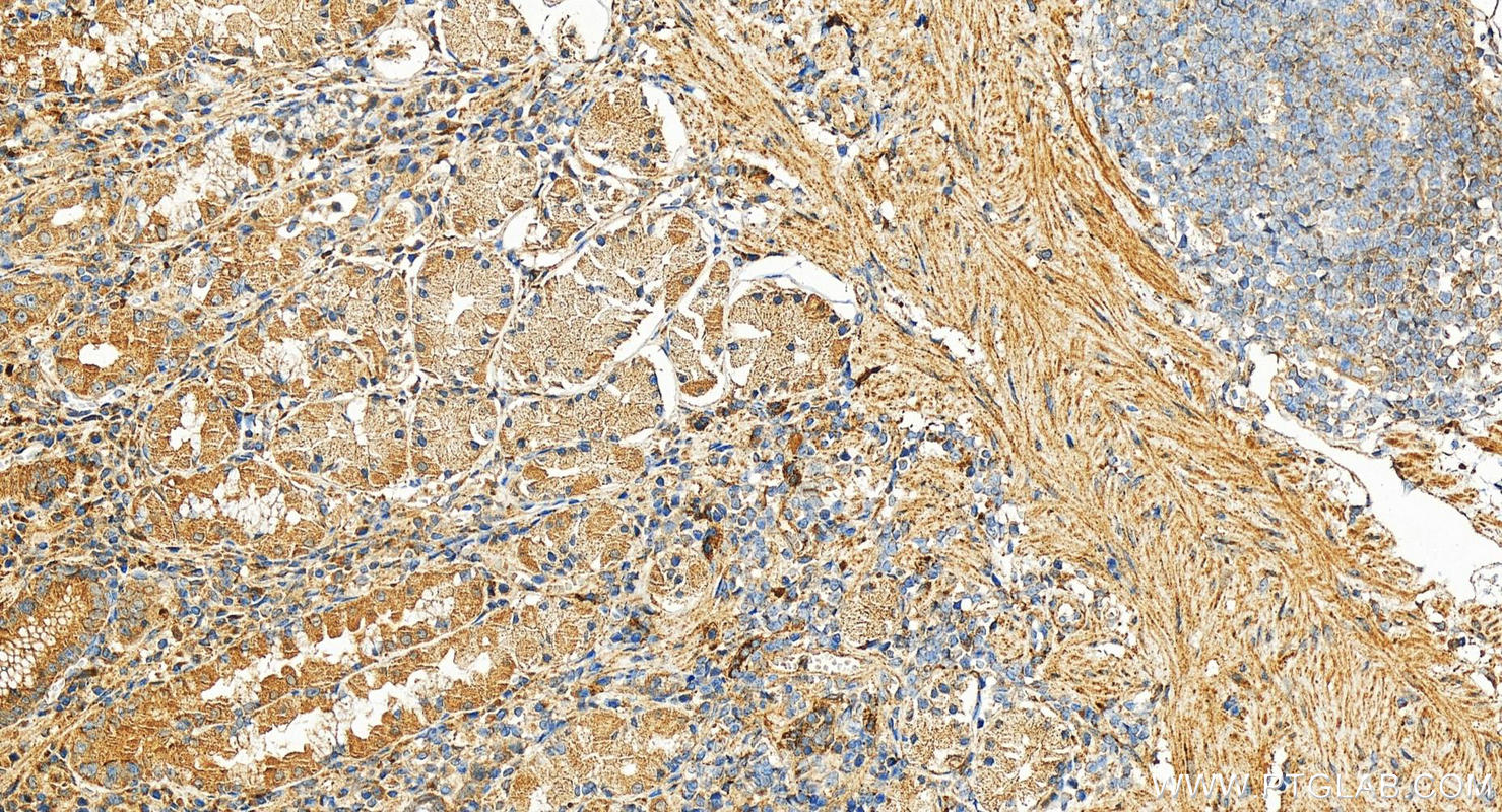 IHC staining of human stomach using 27252-1-AP