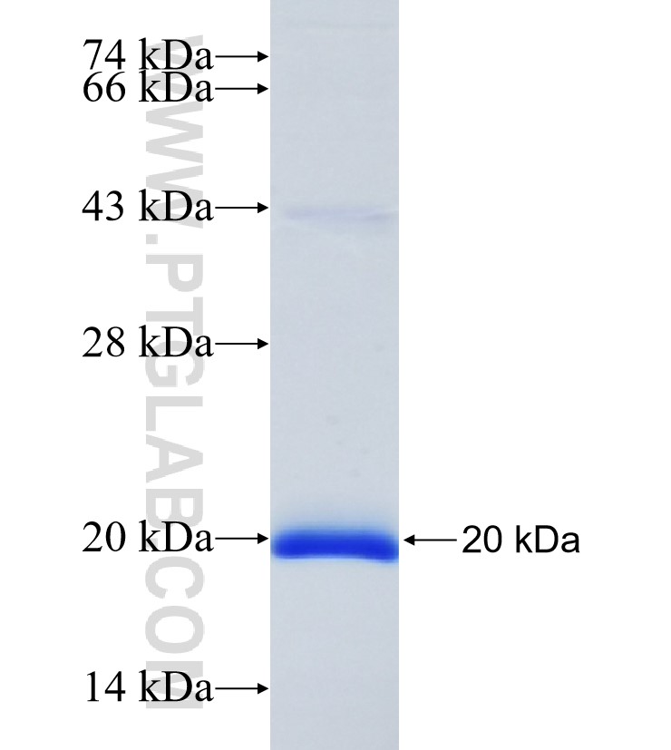 EPDR1 fusion protein Ag26333 SDS-PAGE EPDR1 fusion protein Ag26333 SDS-PAGE