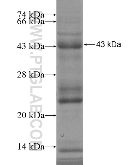 EPHA1 fusion protein Ag19063 SDS-PAGE EPHA1 fusion protein Ag19063 SDS-PAGE