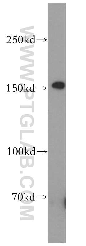 WB analysis of A549 using 18698-1-AP
