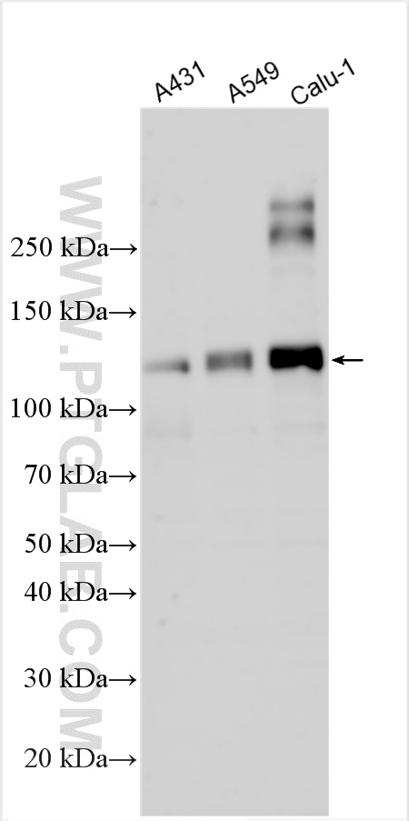 WB analysis using 31469-1-AP