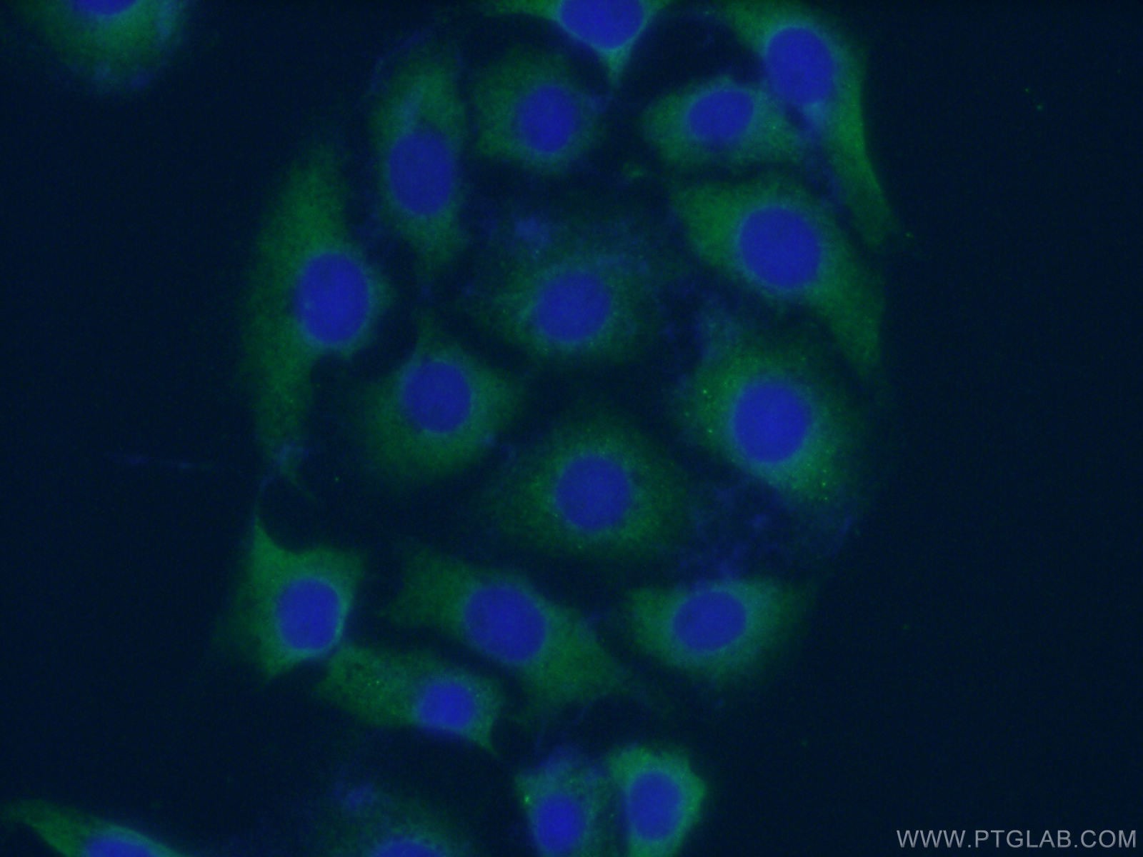 IF Staining of SH-SY5Y using 55215-1-AP