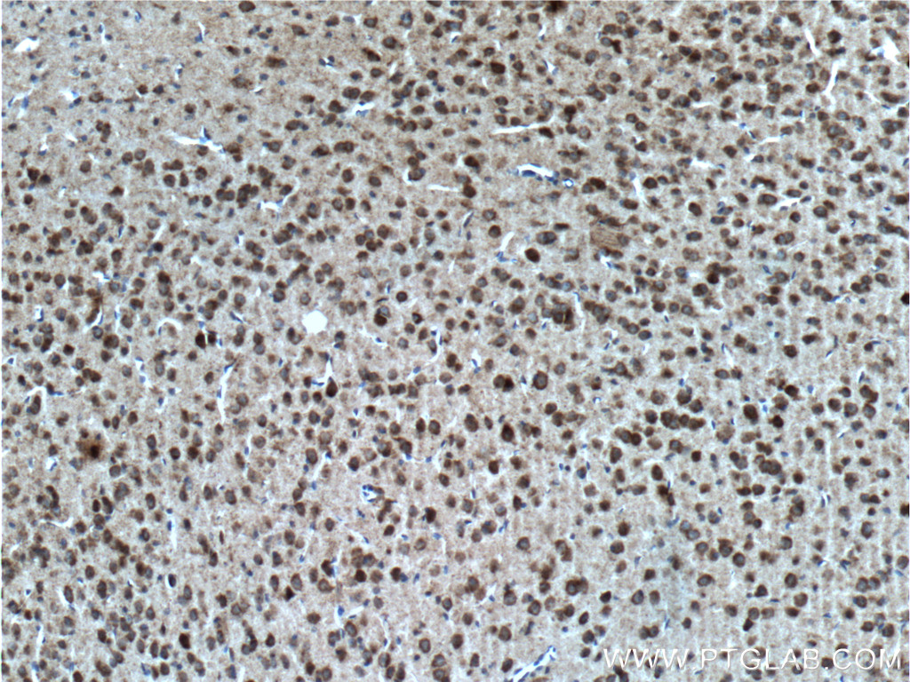 IHC staining of mouse brain using 55215-1-AP