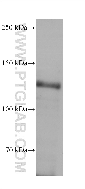 WB analysis of HeLa using 60908-3-Ig