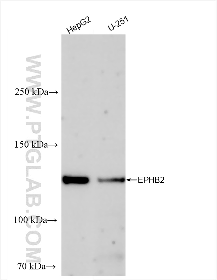 WB analysis using 83277-1-RR