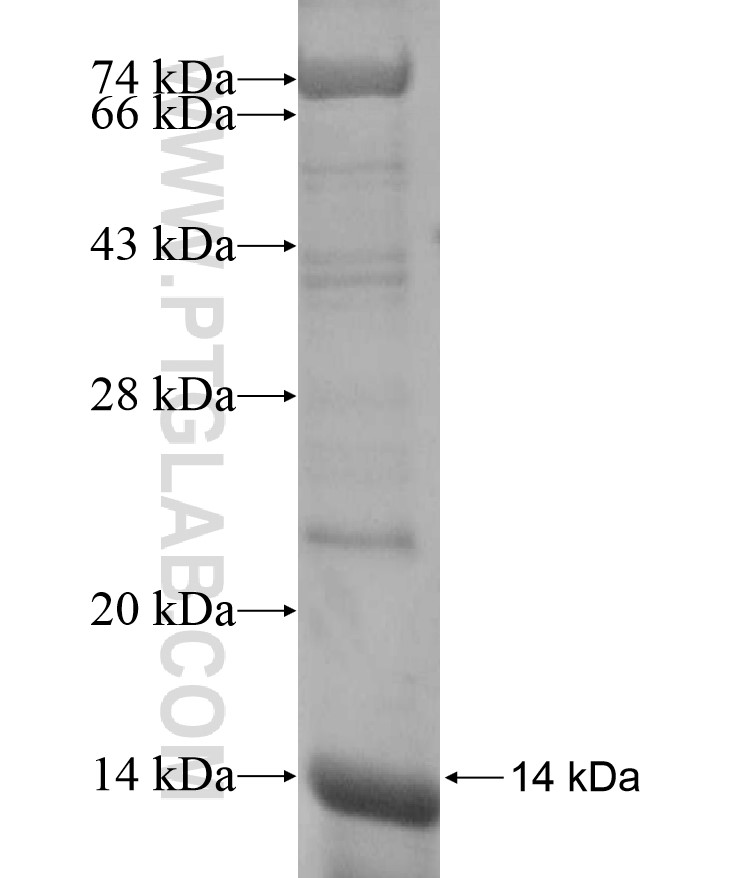 EPHB2 fusion protein Ag17005 SDS-PAGE EPHB2 fusion protein Ag17005 SDS-PAGE