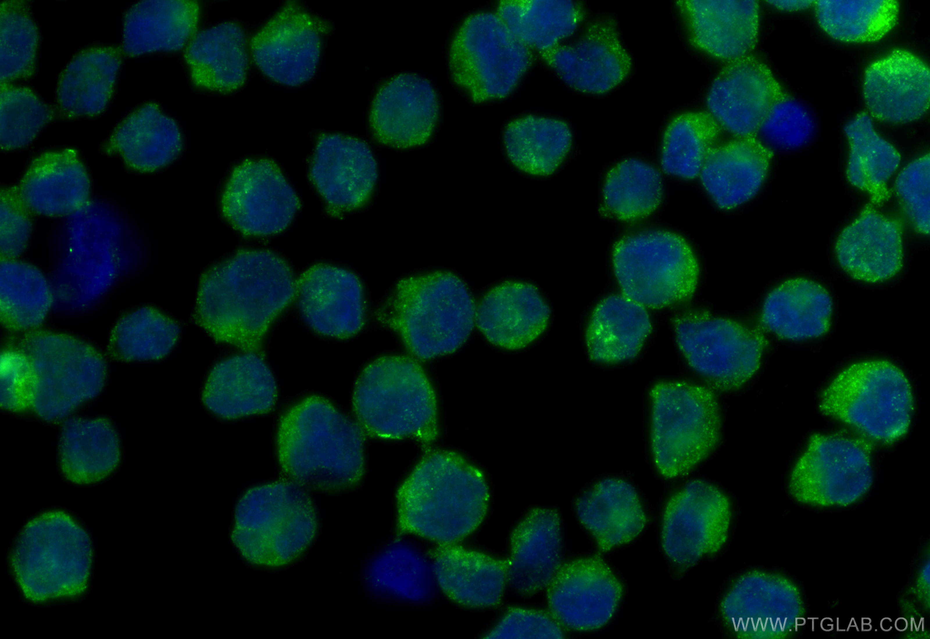 IF Staining of Jurkat using 21382-1-AP