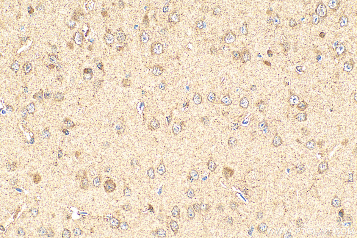 IHC staining of mouse brain using 21382-1-AP