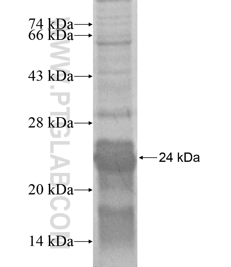 EPHB3 fusion protein Ag17050 SDS-PAGE EPHB3 fusion protein Ag17050 SDS-PAGE