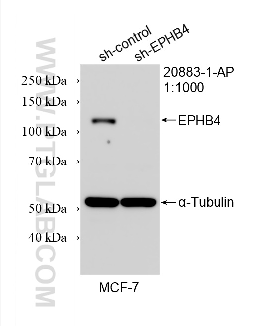 WB analysis of MCF-7 using 20883-1-AP WB analysis of MCF-7 using 20883-1-AP