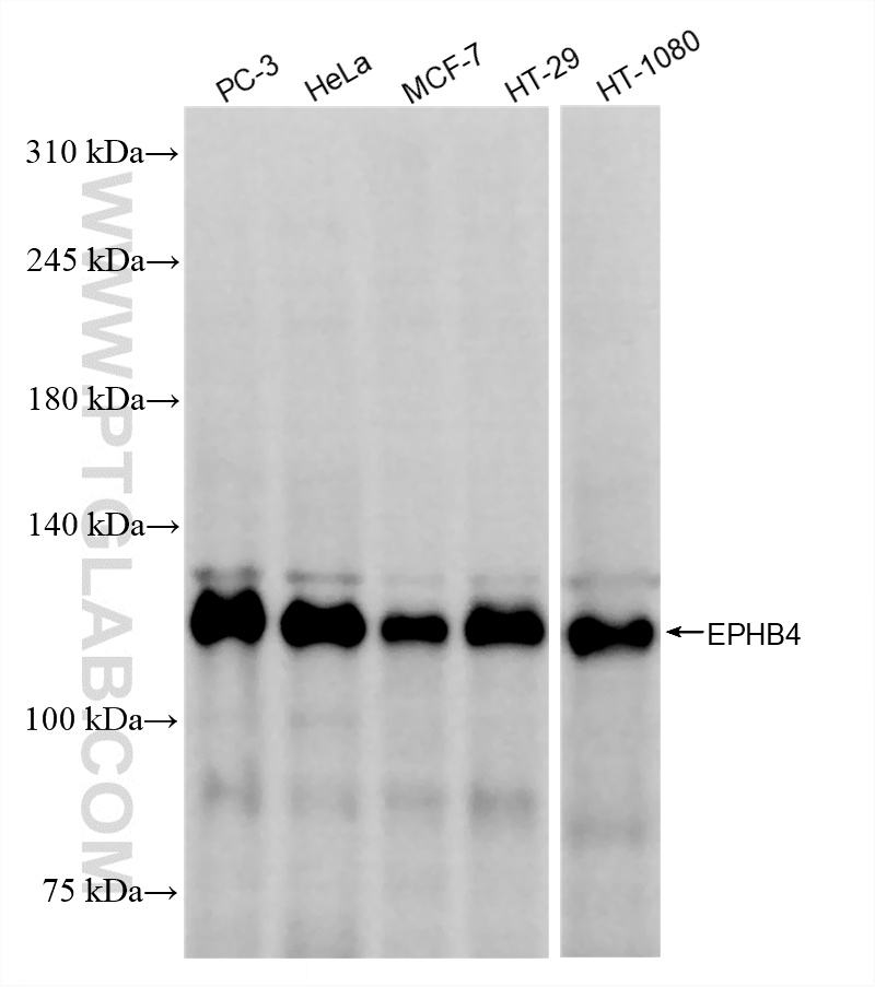 Various lysates were subjected to SDS PAGE followed by western blot with 85139-9-RR (EPHB4 antibody) at dilution of 1:1000 incubated at room temperature for 1.5 hours. WB analysis using 85139-9-RR