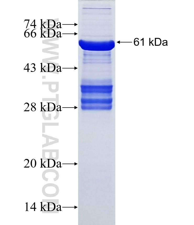 EPHB6 fusion protein Ag15992 SDS-PAGE EPHB6 fusion protein Ag15992 SDS-PAGE