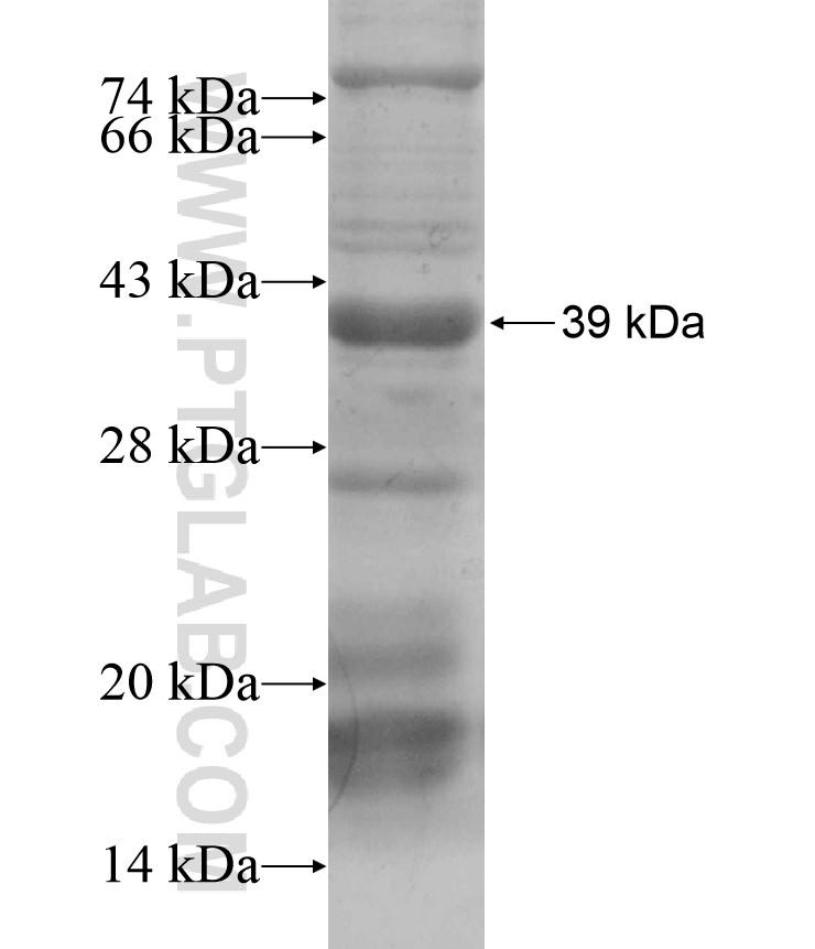 EPHB6 fusion protein Ag17487 SDS-PAGE EPHB6 fusion protein Ag17487 SDS-PAGE