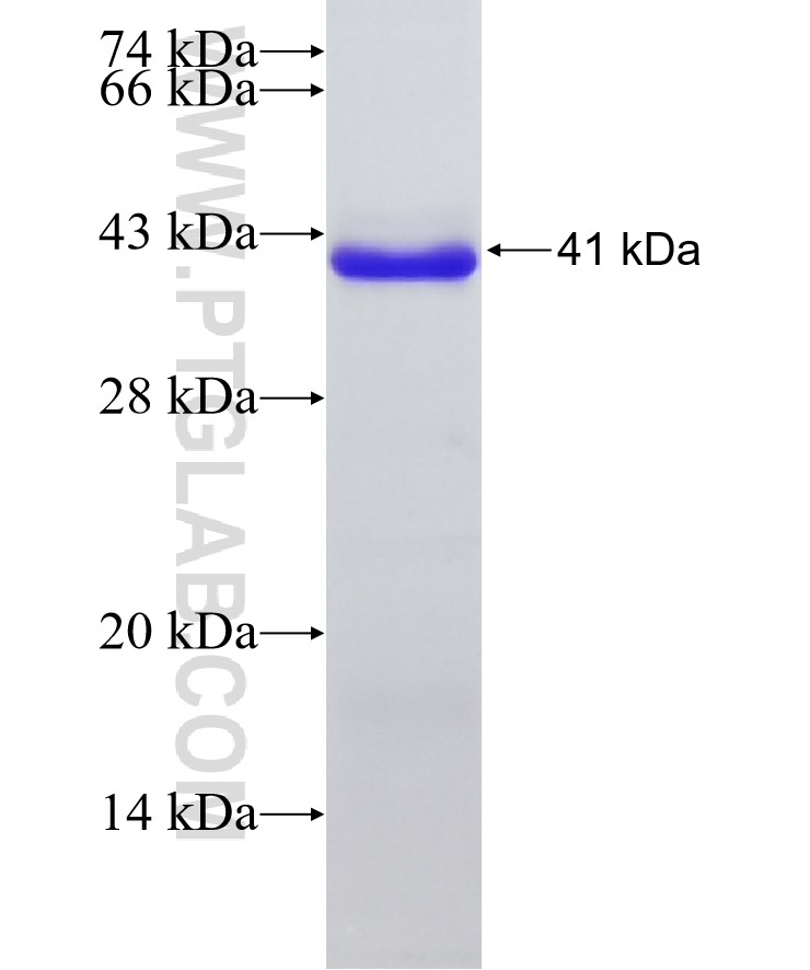 EPHX1 fusion protein Ag25820 SDS-PAGE