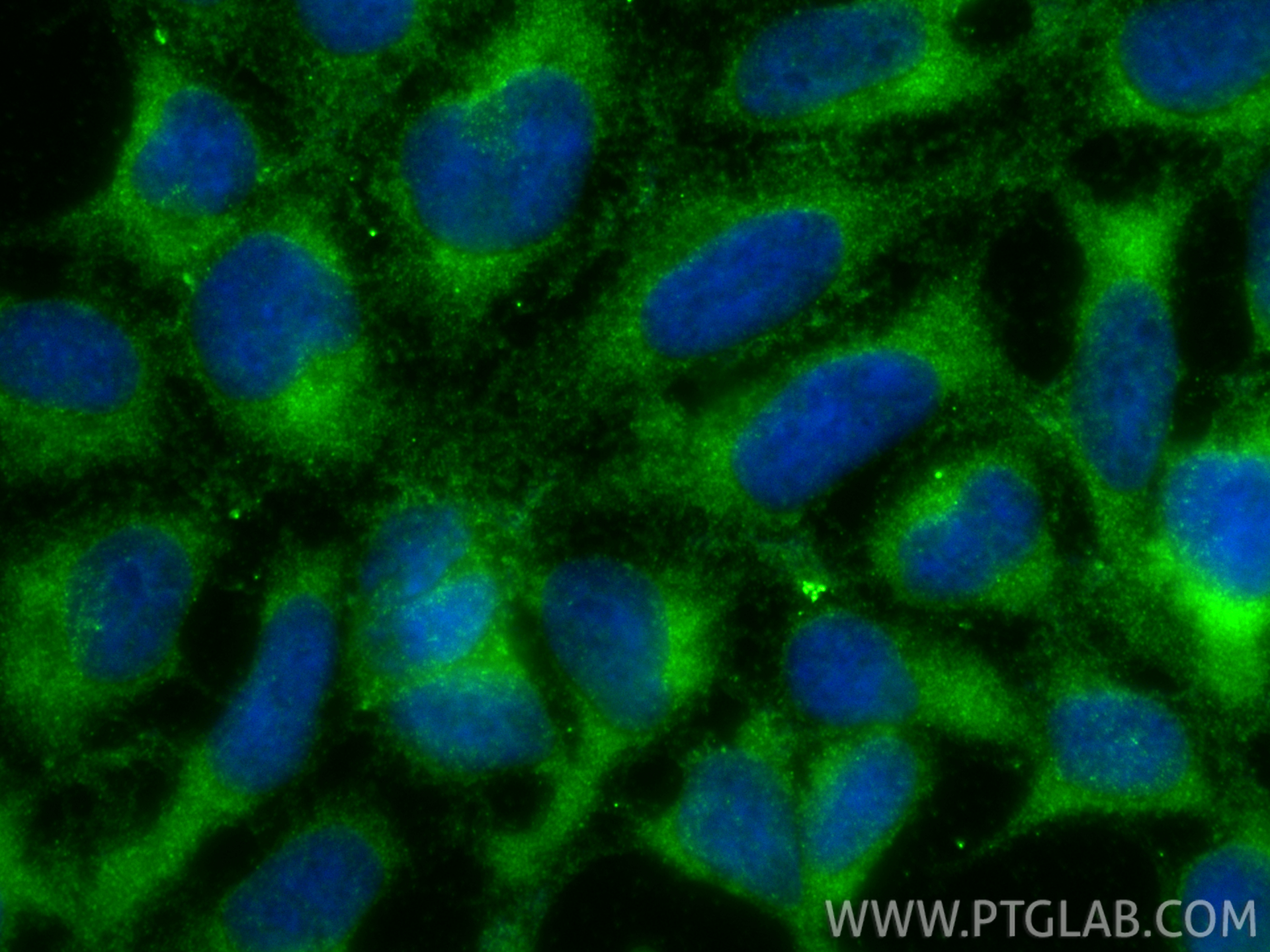 IF Staining of HEK-293 using 10833-1-AP IF Staining of HEK-293 using 10833-1-AP