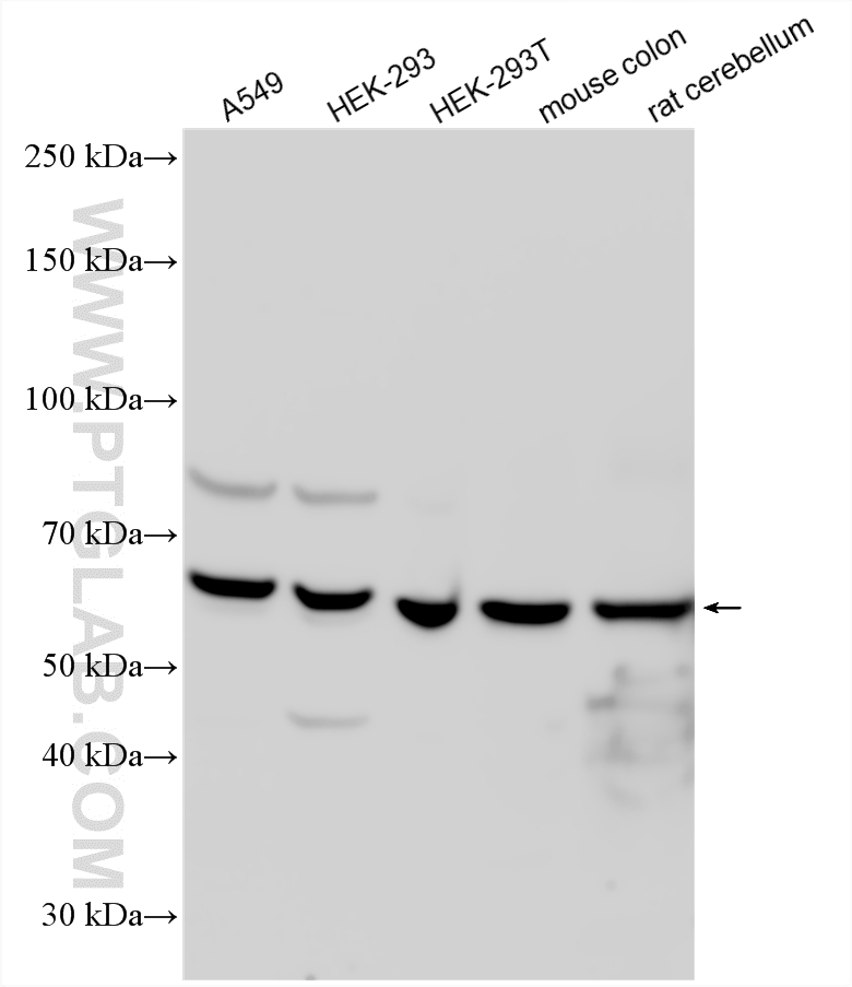 WB analysis using 10833-1-AP