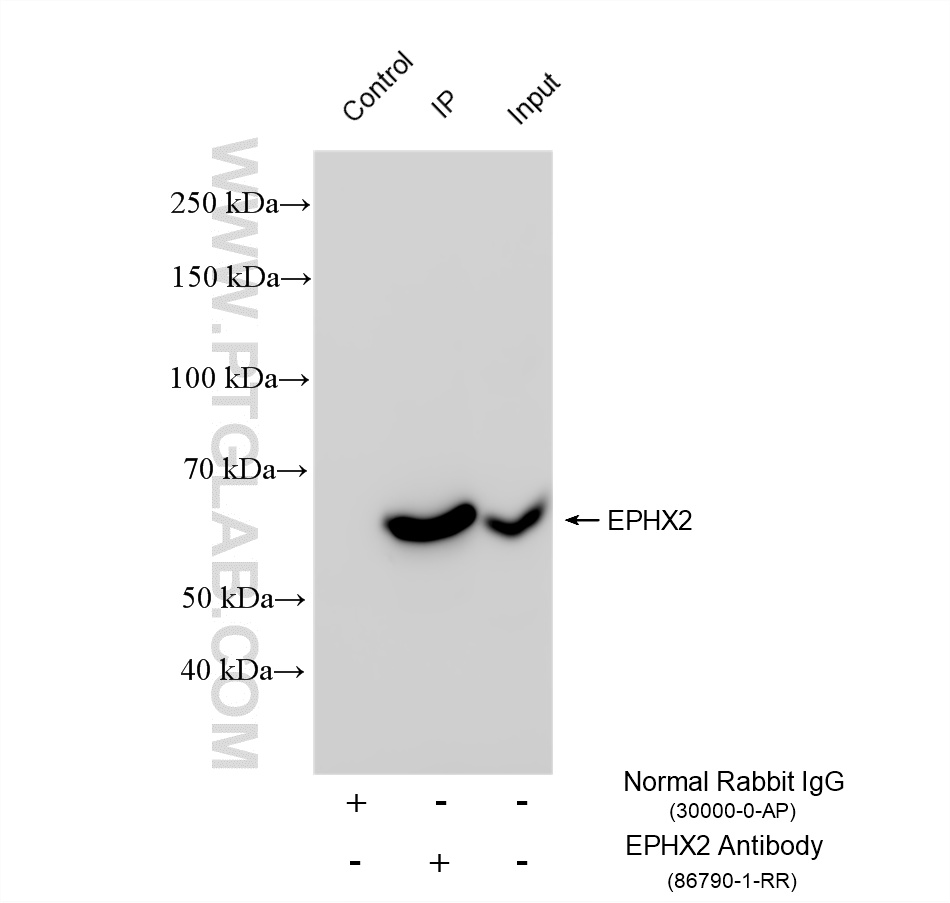 IP experiment of mouse colon using 86790-1-RR (same clone as 86790-1-PBS)