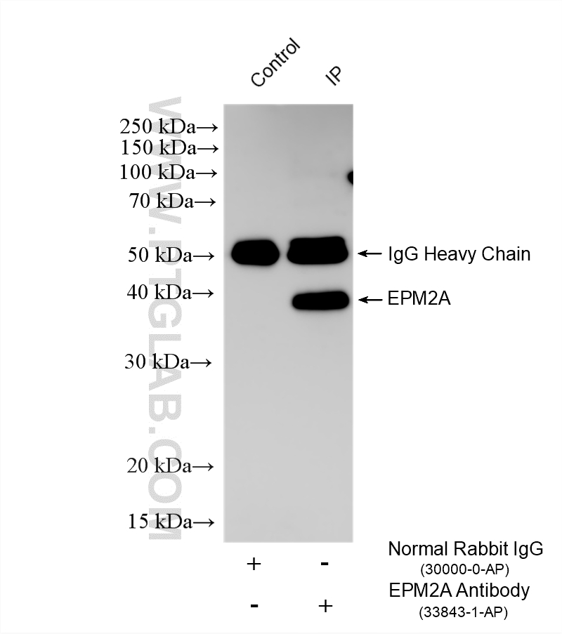 IP experiment of mouse skeletal muscle using 33843-1-AP IP experiment of mouse skeletal muscle using 33843-1-AP