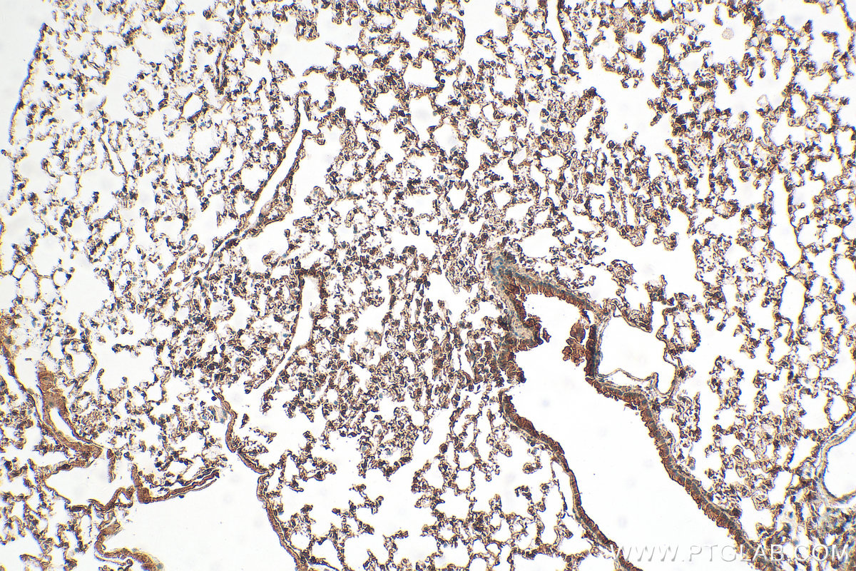 IHC staining of mouse lung using 31334-1-AP