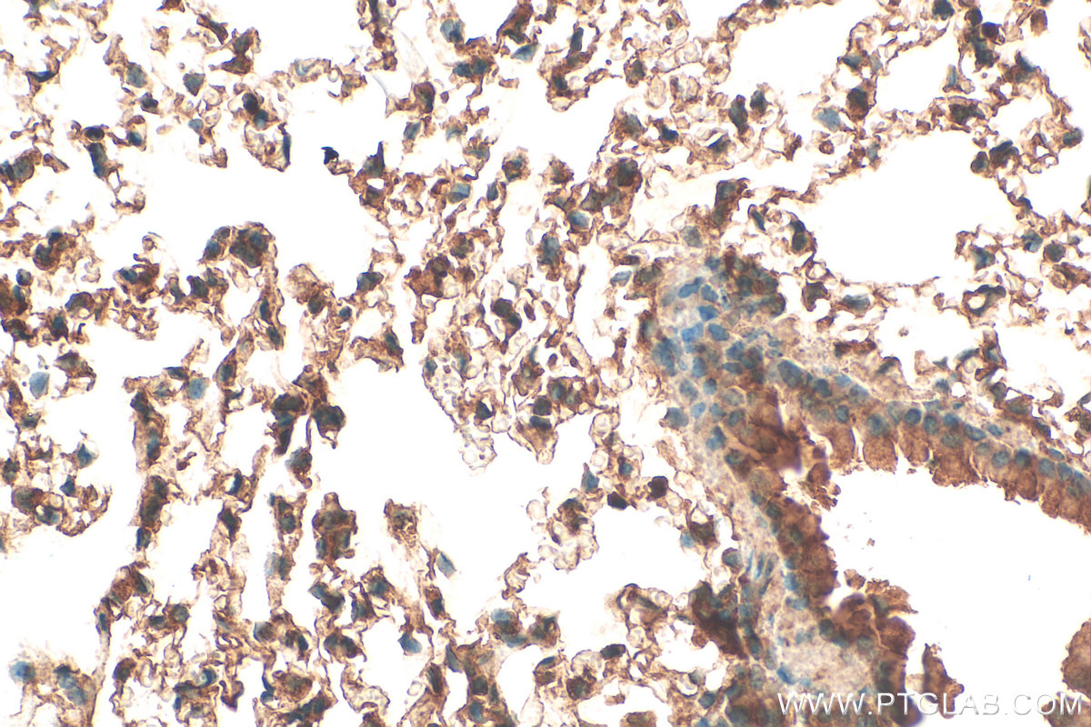 IHC staining of mouse lung using 31334-1-AP