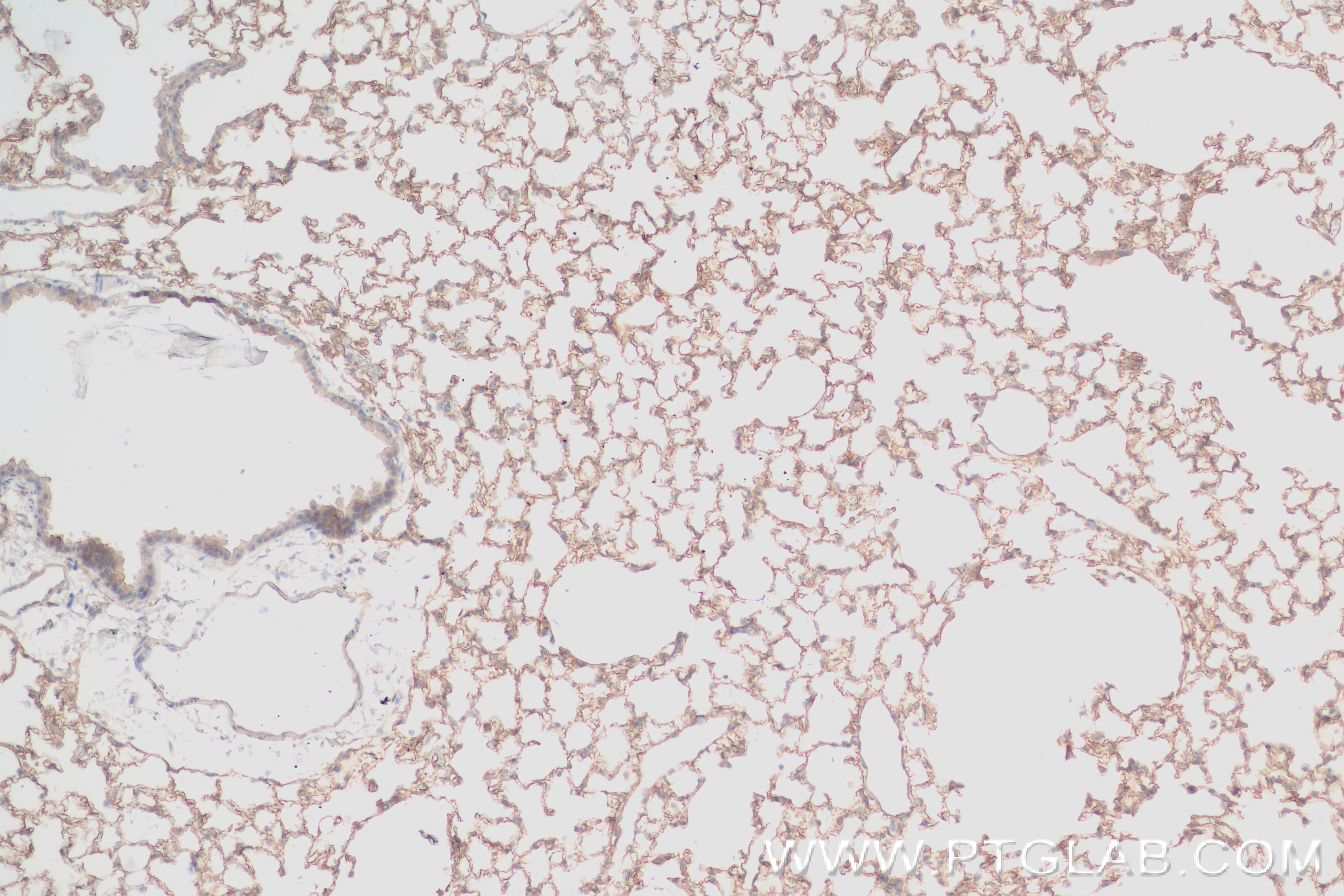 IHC staining of mouse lung using 84366-5-RR (same clone as 84366-5-PBS)