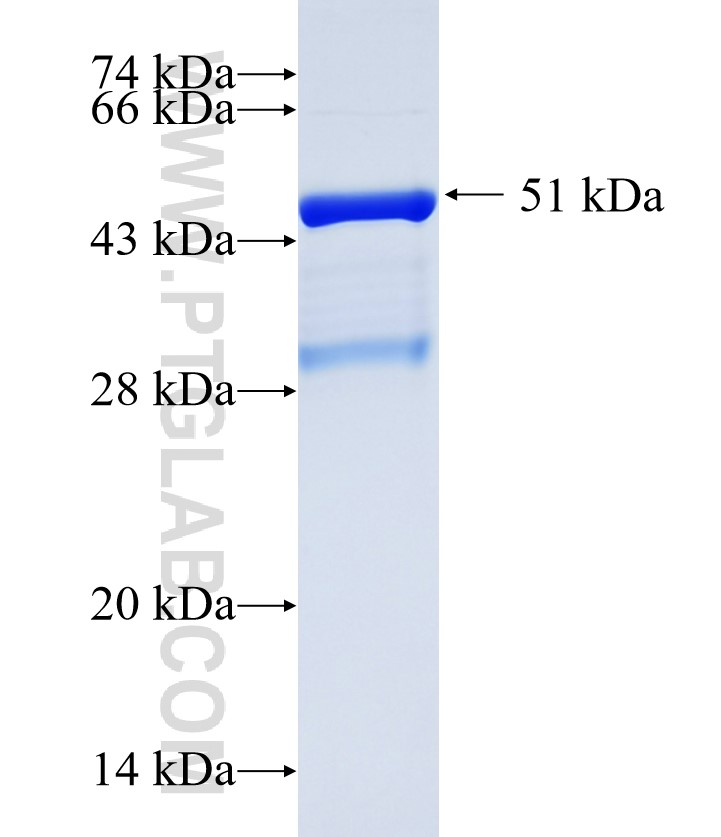 EPN2 fusion protein Ag35194 SDS-PAGE