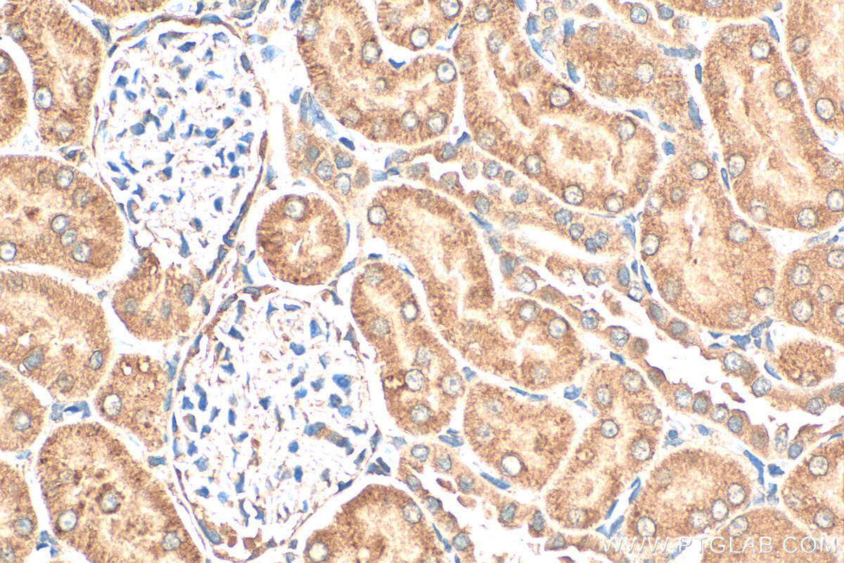 IHC staining of rat kidney using 17908-1-AP (same clone as 17908-1-PBS)
