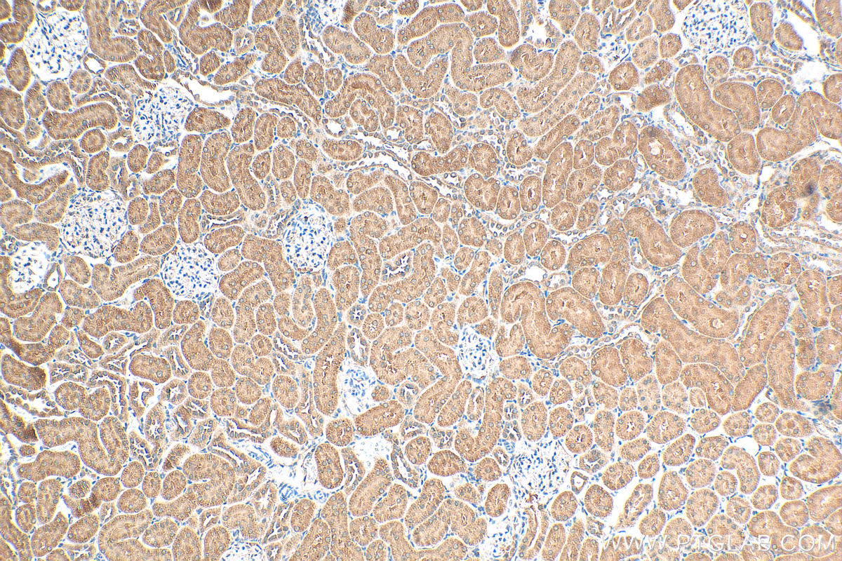 IHC staining of rat kidney using 17908-1-AP (same clone as 17908-1-PBS)