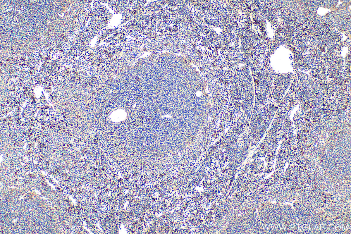 IHC staining of mouse spleen using 17908-1-AP