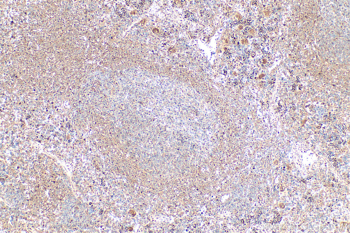 IHC staining of rat spleen using 17908-1-AP