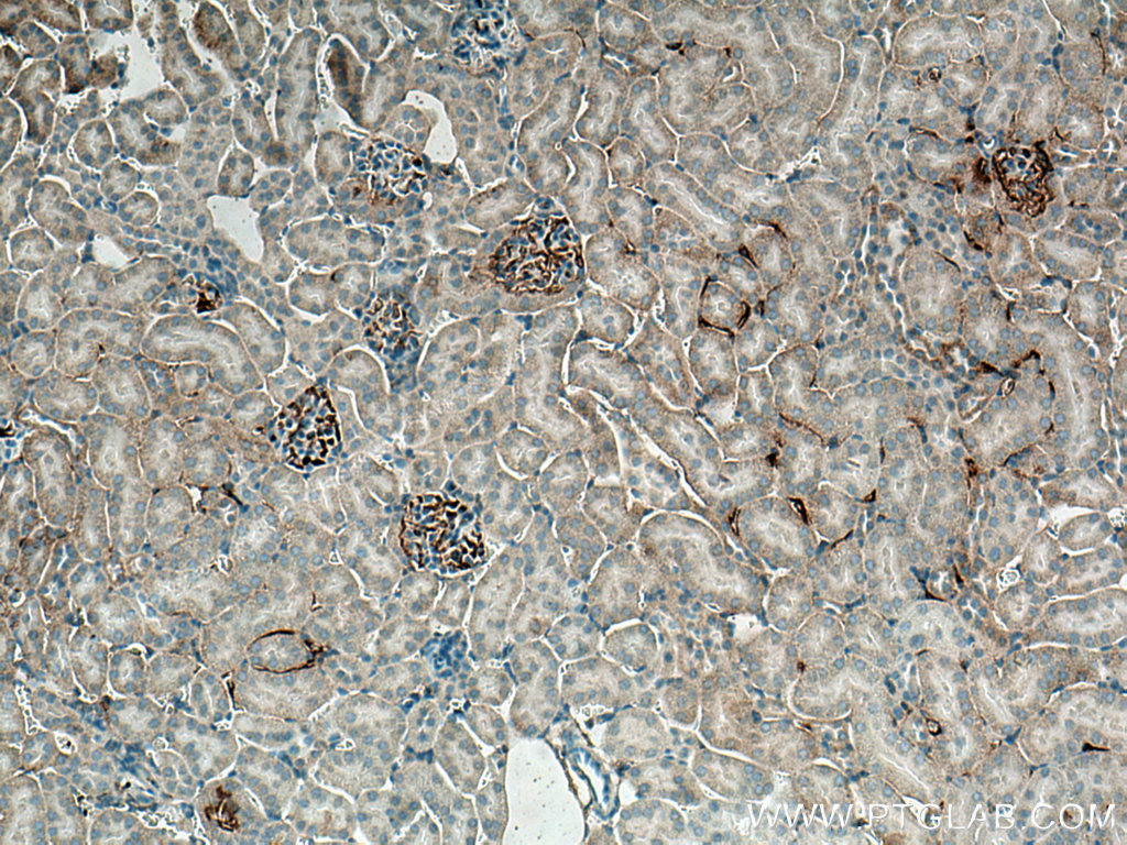 EPO/Erythropoietin