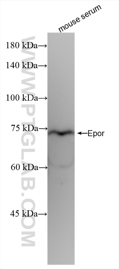 WB analysis using 85901-1-RR