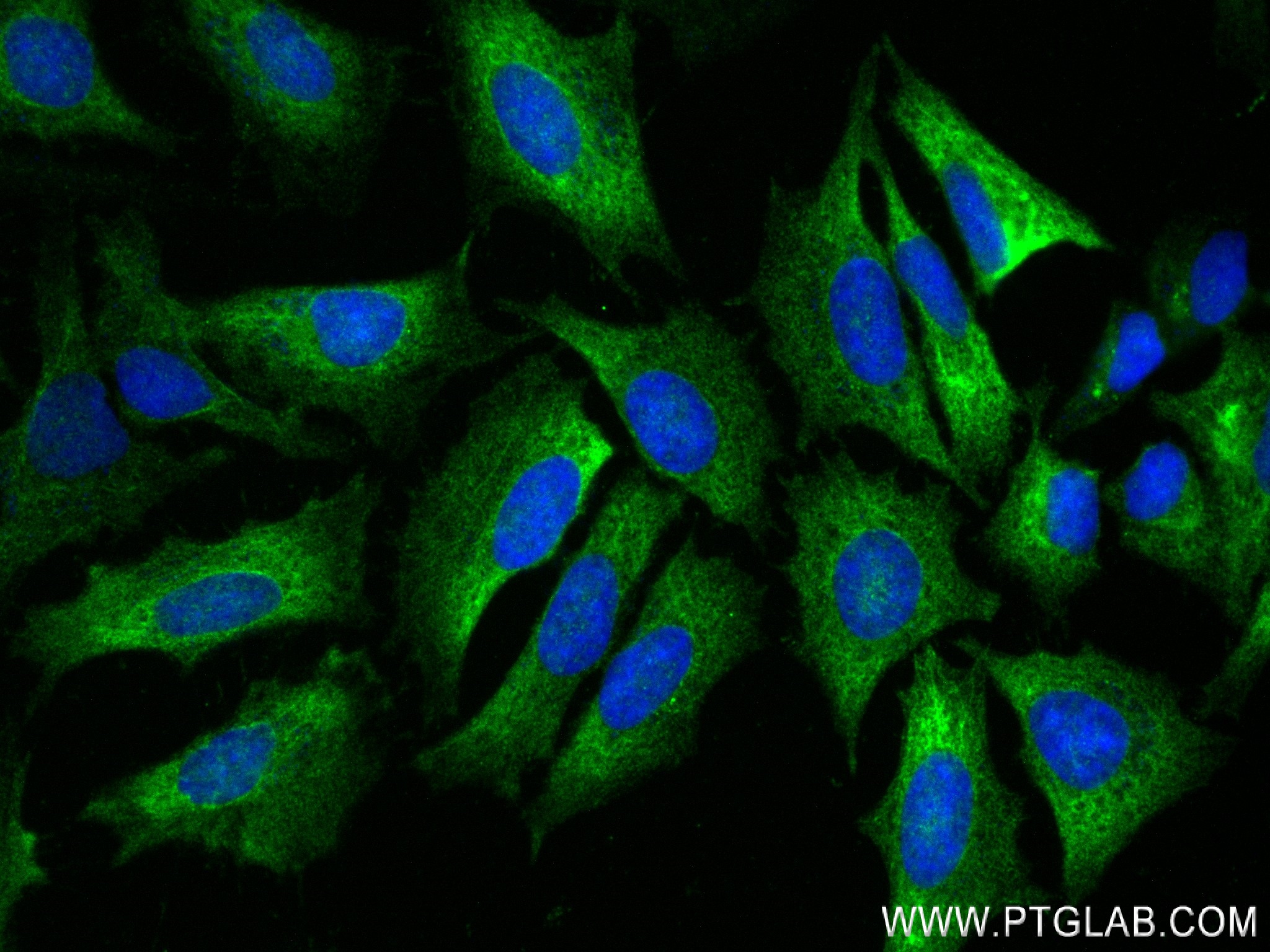 IF Staining of HeLa using 84344-2-RR