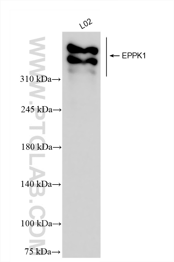 WB analysis of L02 using 84344-2-RR