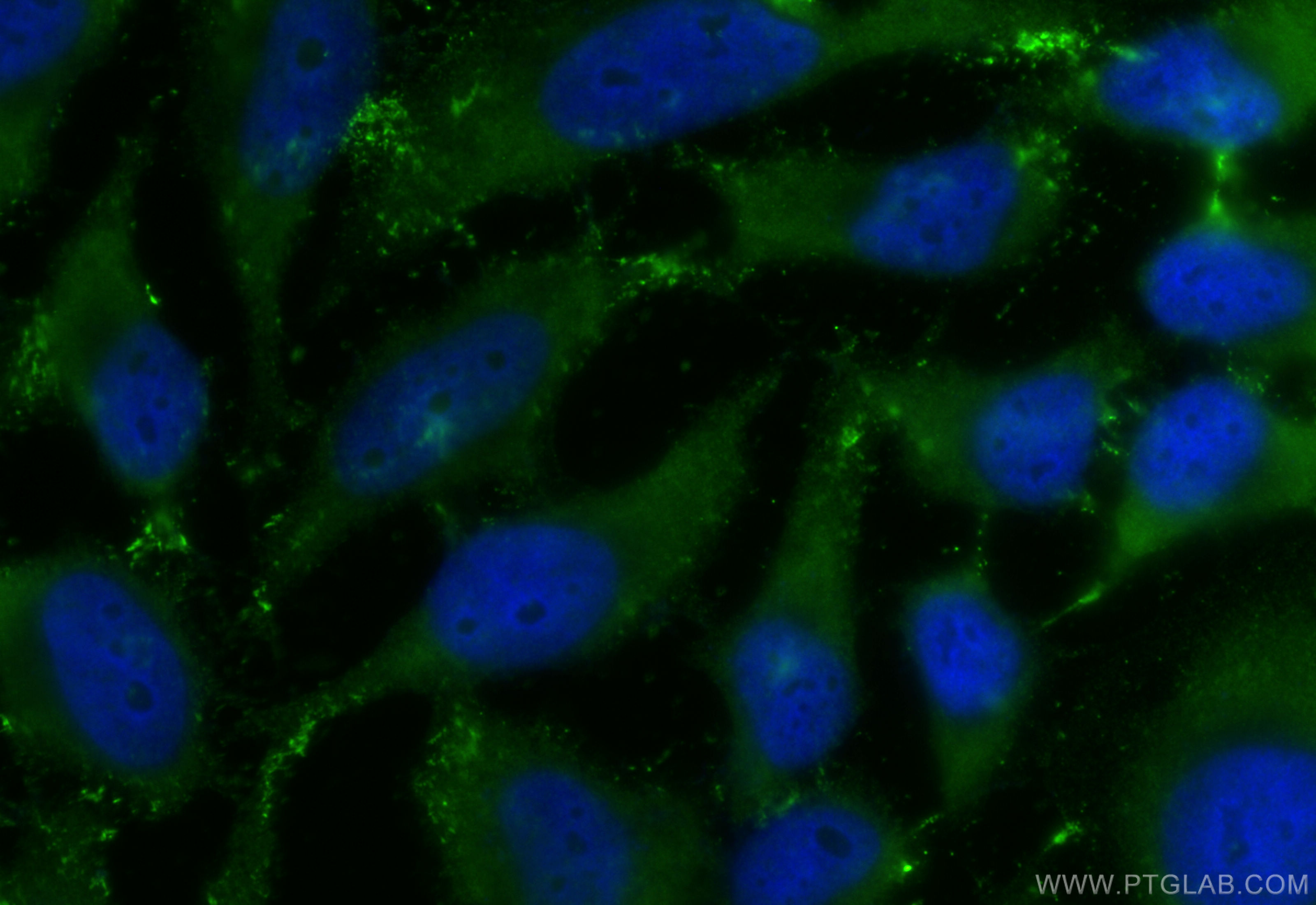 IF Staining of HeLa using CL488-84344-2