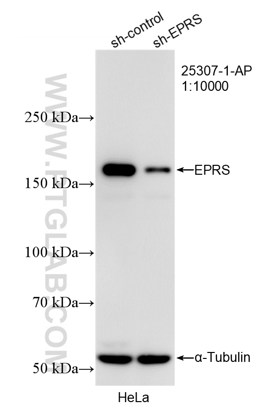 WB result of EPRS antibody (25307-1-AP; 1:10000; incubated at room temperature for 1.5 hours) with sh-Control and sh-EPRS transfected HeLa cells. WB analysis of HeLa using 25307-1-AP
