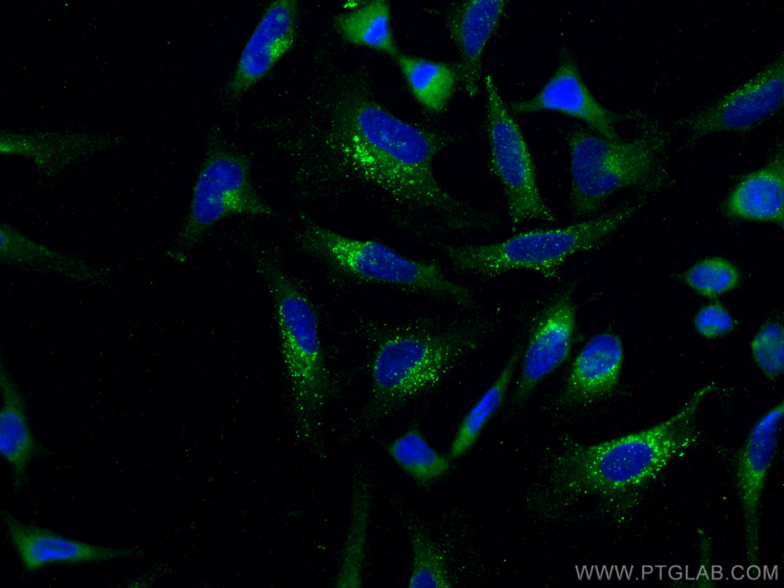 IF Staining of HeLa using 67712-1-Ig