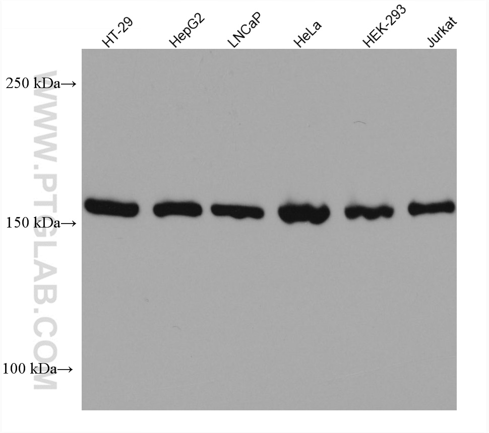 WB analysis using 67712-1-Ig