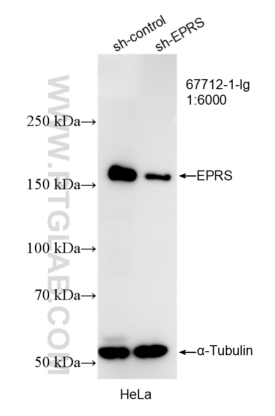 WB result of EPRS antibody (67712-1-Ig; 1:6000; incubated at room temperature for 1.5 hours) with sh-Control and sh-EPRS transfected HeLa cells. WB analysis of HeLa using 67712-1-Ig