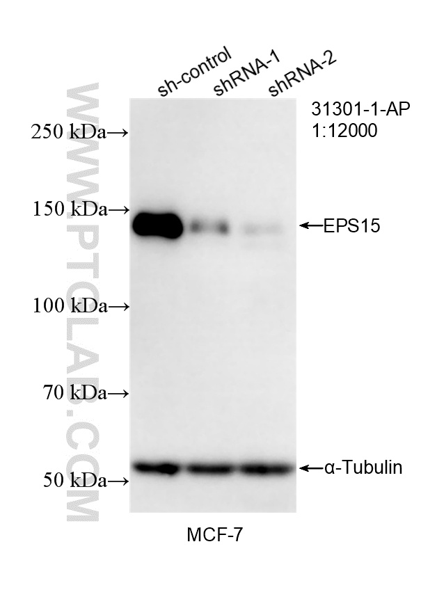 WB result of EPS15 antibody (<a class='green' href='/productredirect?CatalogNo=31301-1-AP' target='_blank'>31301-1-AP</a>; 1:12000; incubated at room temperature for 1.5 hours) with sh-Control and sh-EPS15 transfected MCF-7 cells. This data was developed using the same antibody clone with 31301-1-PBS in a different storage buffer formulation. WB analysis of MCF-7 using 31301-1-AP (same clone as 31301-1-PBS)