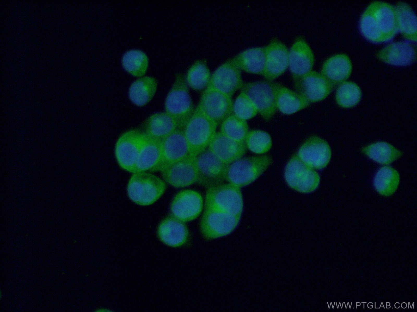 IF Staining of BxPC-3 using 21243-1-AP