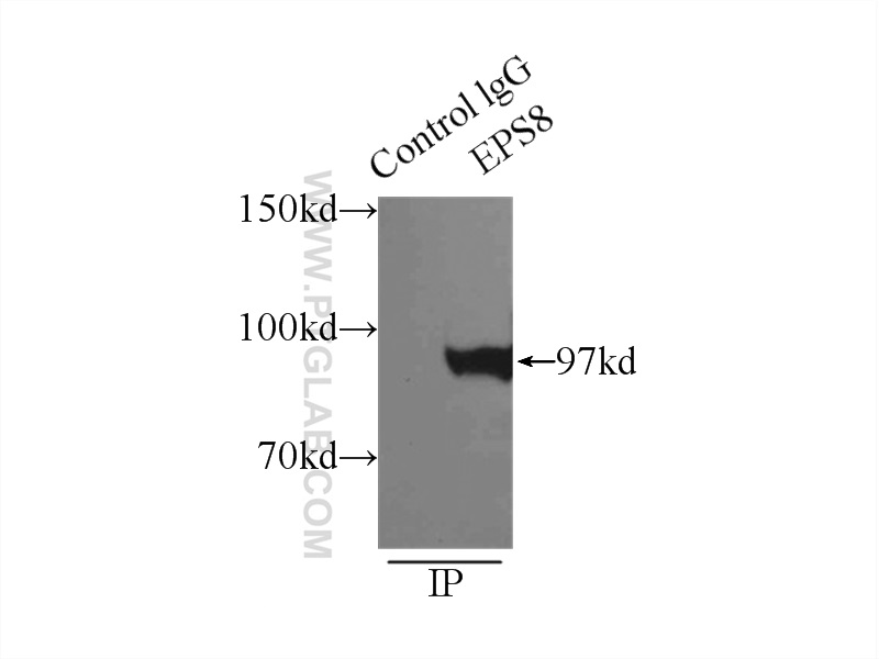 IP experiment of HeLa using 12455-1-AP