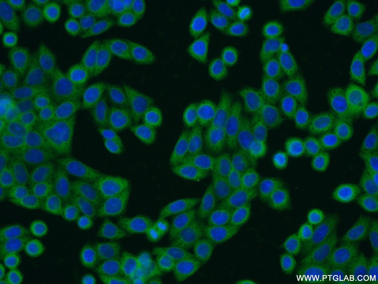 IF Staining of HeLa using 20461-1-AP