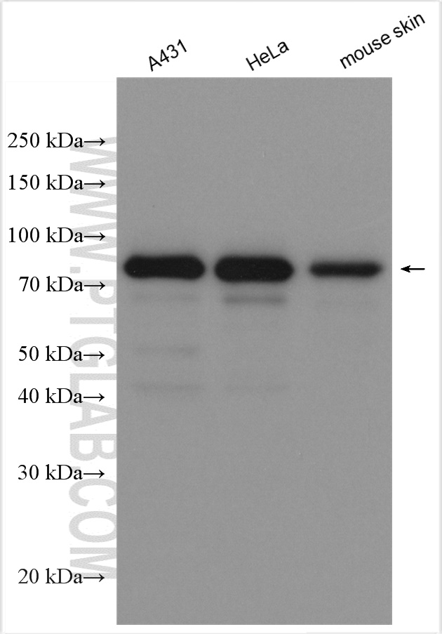 WB analysis using 20461-1-AP