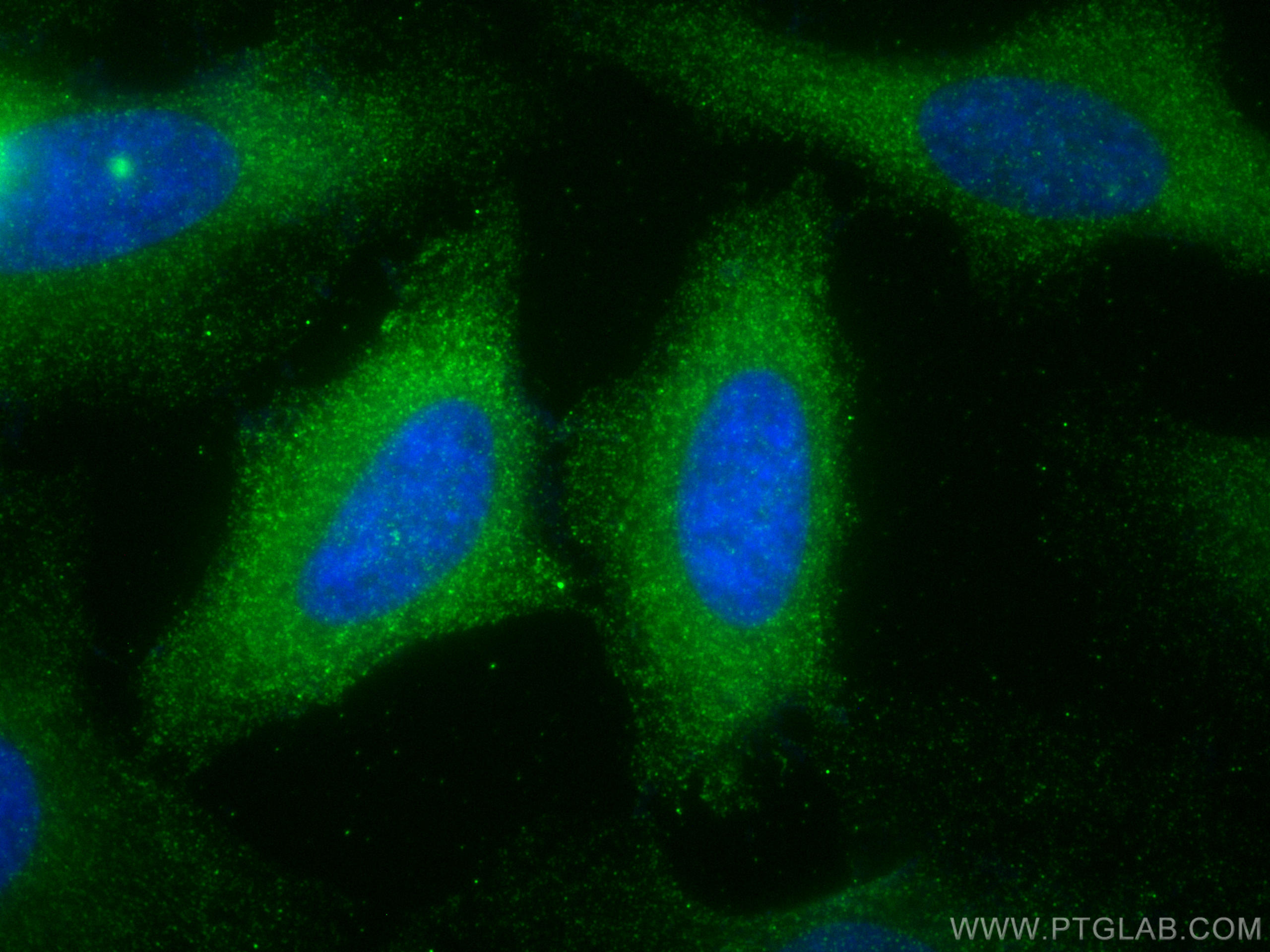 IF Staining of HeLa using 68330-1-Ig